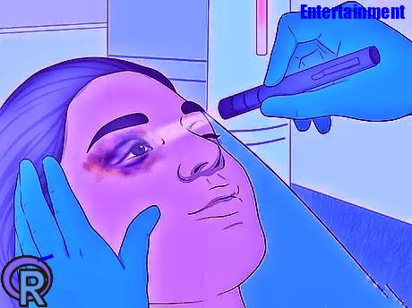 Fastest Way To Get Rid Of A Black Eye